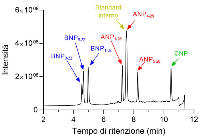 biomarcatori scompenso cardiaco plasma f2