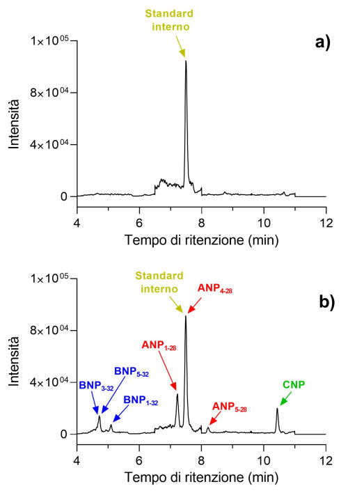 biomarcatori scompenso cardiaco plasma f6